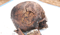 의문사한 장준하 선생 유골 공개