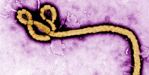 WCC, 에볼라 감염 사태 우려 표명 