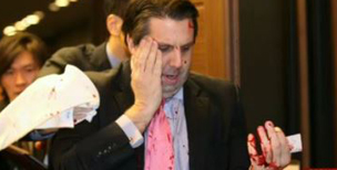 진보 교계, 마크 리퍼트 주한미국대사 피습에 유감